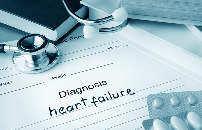 What is heart failure? Causes, symptoms, risk factors, and treatments