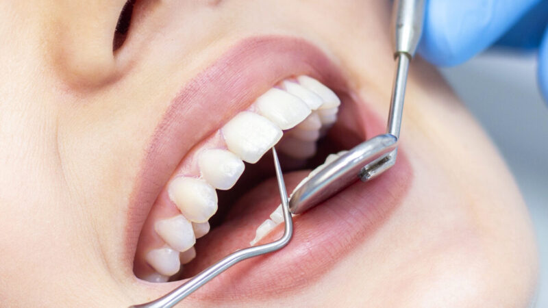 Key Factors to Consider When Selecting an Orthodontist in Abu Dhabi