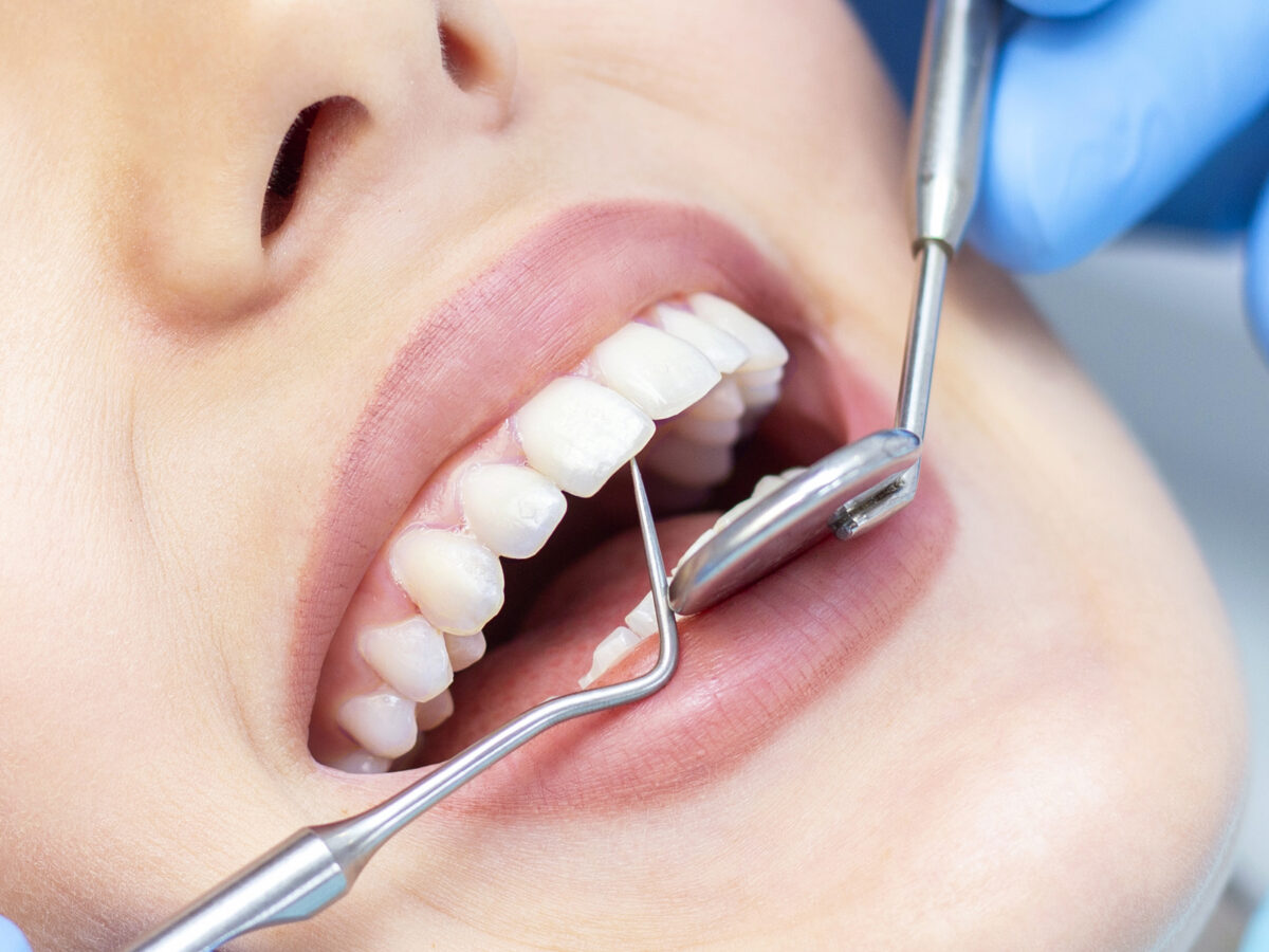 Key Factors to Consider When Selecting an Orthodontist in Abu Dhabi