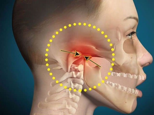 TMJ Doctor: Expert Care for Jaw Pain and Temporomandibular Disorders